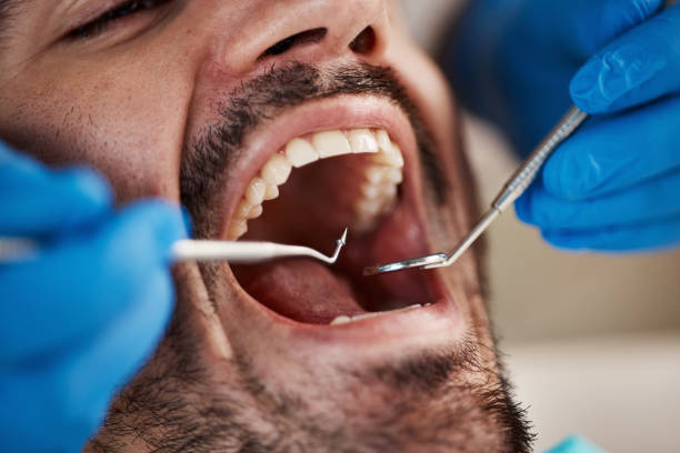 Trusted CA Emergency Dental Service Experts